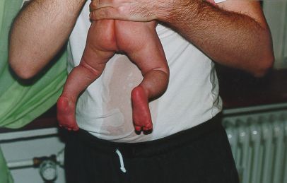 {short description of image}